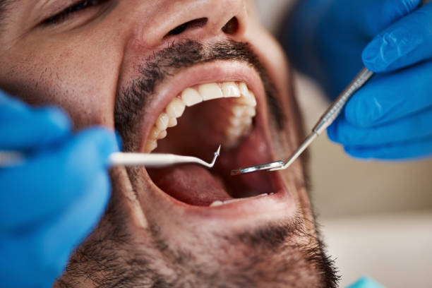 Best Emergency Tooth Extraction in South Berwick, ME