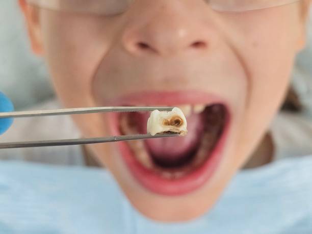 Best Pediatric Emergency Dentist in South Berwick, ME