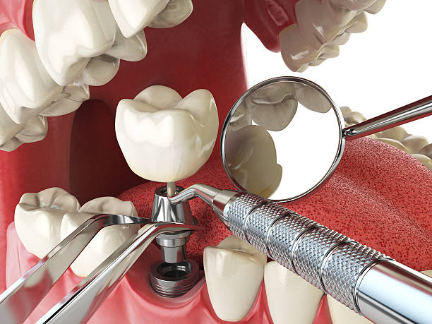 Best After-Hours Dental Trauma Care in South Berwick, ME